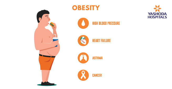 Obesity Lead to Cancer